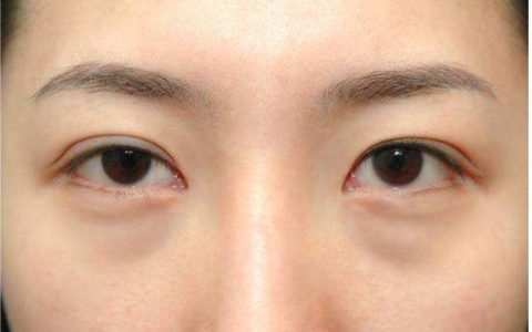 眼部肌肤护理的核心：眼霜的科学认知与实践