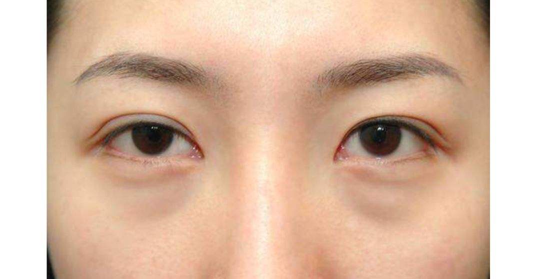 眼部肌肤护理的核心：眼霜的科学认知与实践