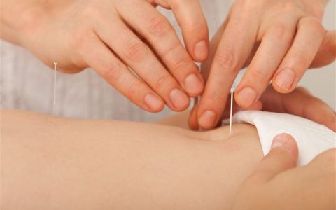 扎针还能这么玩？解锁针灸那些让人笑出眼泪的冷知识