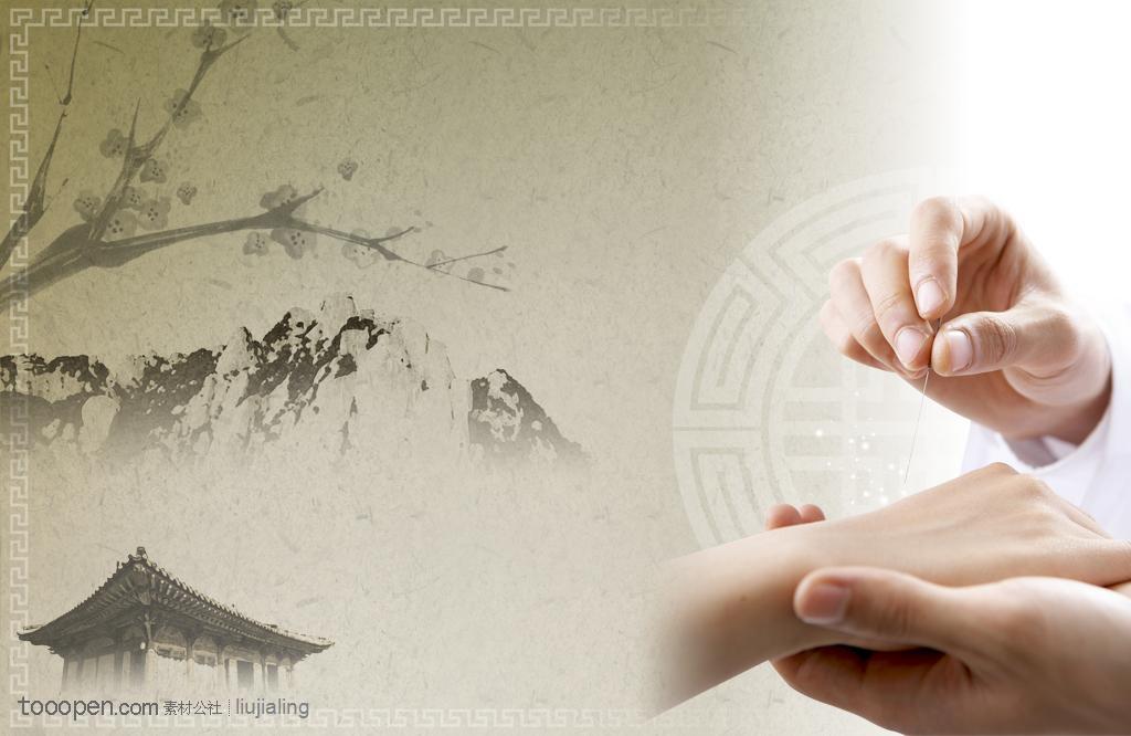 银针细语：解码针灸疗法的千年智慧与当代实践