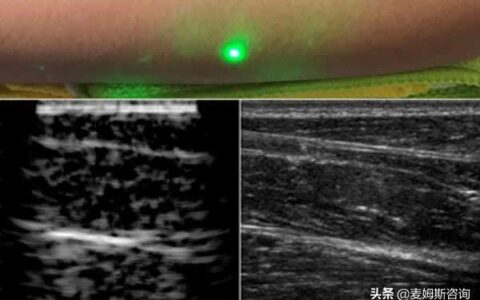 无声的守护：超声成像里的生命温度